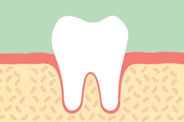 4 Dangerous Signs: It's Time for Root Canal Treatment